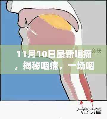 揭秘咽痛,咽喉深处的战役——最新日期下的背景、事件、影响与时代地位